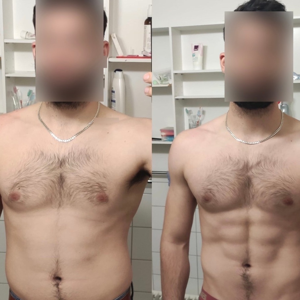 Transformation avant / après d’un membre Beexfit