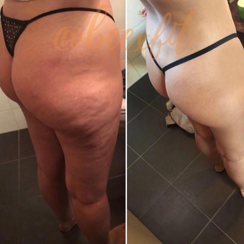 Transformation avant / après d’un membre Beexfit